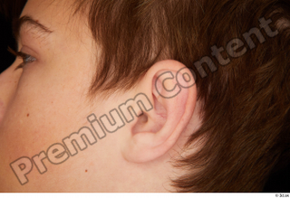 Matthew ear 0001.jpg